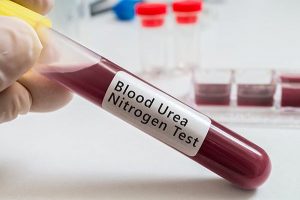 Blood Urea Nitrogen Test